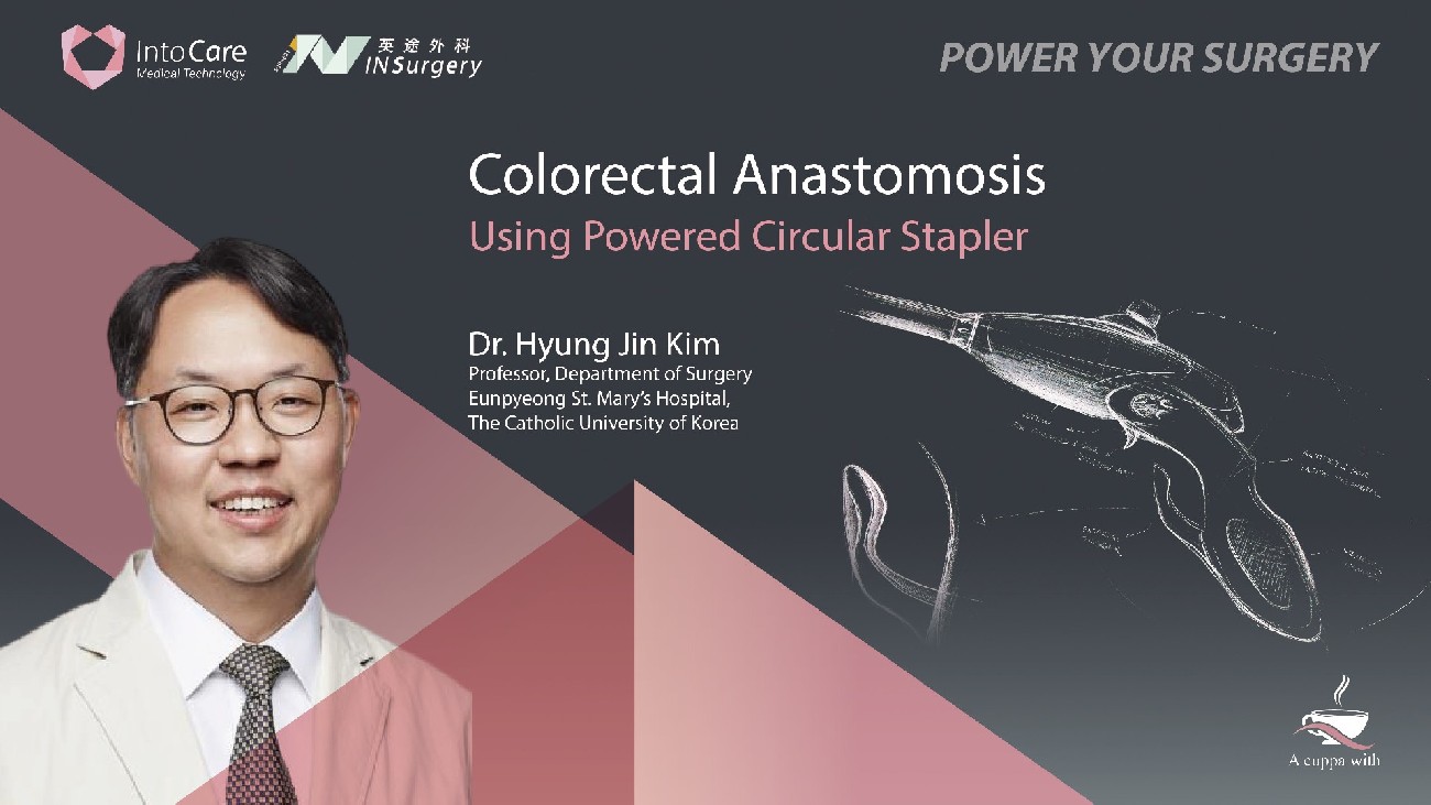 Colorectal Anastomosis Using Powered Circular Stapler